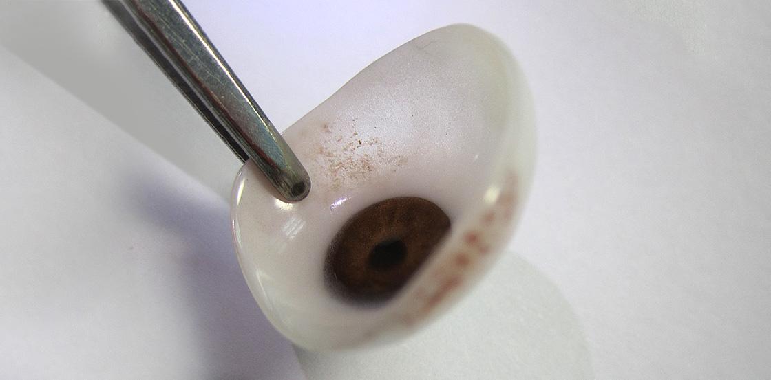 義眼片的選擇指南