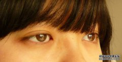 個(gè)性化義眼與傳統(tǒng)義眼、成品義眼之間的區(qū)別