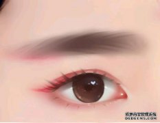 人工義眼應該如何保養(yǎng)？