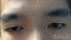 數(shù)字化美學義眼定制服務是什么意思