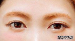 配戴義眼是否還需要動手術?