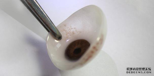 高仿真超薄義眼(假眼)的定制技術(shù)和應(yīng)用